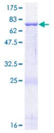 SDS-PAGE (CD209-0748H).jpg